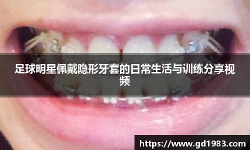 足球明星佩戴隐形牙套的日常生活与训练分享视频